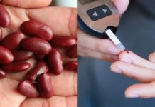 აი, რატომაა აუცილებელი დიაბეტიანი ადამიანებისათვის ლობიოს მიღება. ეს უნდა იცოდეთ!