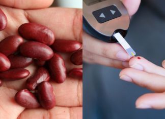 აი, რატომაა აუცილებელი დიაბეტიანი ადამიანებისათვის ლობიოს მიღება. ეს უნდა იცოდეთ!