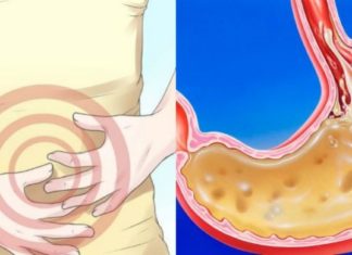 ამის გამოყენების შემდეგ სამუდამოდ დაივიწყებთ გასტრიტს!  ეფექტური საშუალება!