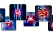 სახსრების აღდგენა ოპერაციის გარეშე