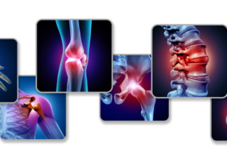 სახსრების აღდგენა ოპერაციის გარეშე