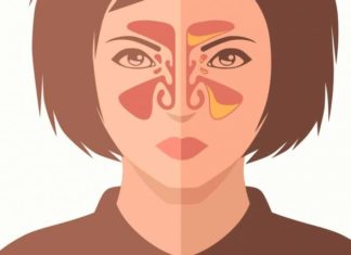 დააღწიეთ თავი ჰაიმორიტის მტანჯველ დაავადებას ამ მეთოდის დახმარებით! ამოვისუნთქე