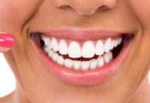 საუკეთესო ნატურალური პროდუქტები კბილების გათეთრებისთვის. გახადეთ თქვენი ღიმილი უფრო მომხიბვლელი