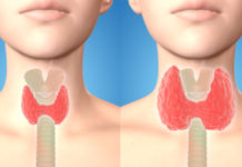 გამოიყენეთ ეს რეცეპტი და უთხარით არა ფარისებრი ჯირკვლის პრობლემებს!