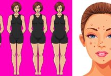 აი, რა შეიძლება იყოს წონაში მატების, თმის ცვენის, ოფლიანობის, დაღლილობის და უძილობის მთავარი მიზეზი