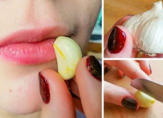 ჰერპესის გაქრობის ყველაზე იაფი და მარტივი რეცეფტები