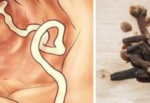 პროდუქტები, რომლებიც ორგანიზმს პარაზიტებისგან იცავენ. ეს უნდა იცოდეთ!