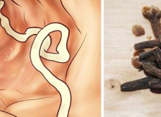 პროდუქტები, რომლებიც ორგანიზმს პარაზიტებისგან იცავენ. ეს უნდა იცოდეთ!