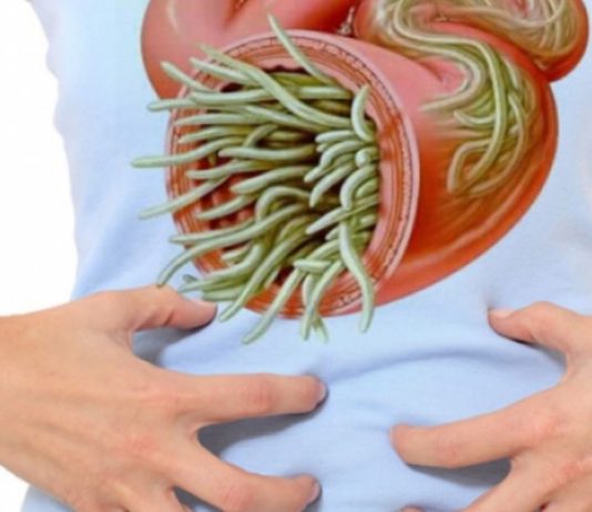 გამოდევნეთ ორგანიზმიდან პარაზიტები ხალხური მედიცინის დახმარებით