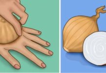 ჯანმრთელობასთან დაკავშირებული 5 პრობლემა, რომელსაც ხახვის დახმარებით გადაჭრით