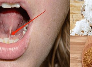 ენის ქვეშ ამის ამოდებით 5 კილოს დაიკლებთ 1 კვირაში! ეს ვარჯიშს და დიეტას დაგავიწყებთ