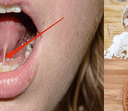 ენის ქვეშ ამის ამოდებით 5 კილოს დაიკლებთ 1 კვირაში! ეს ვარჯიშს და დიეტას დაგავიწყებთ