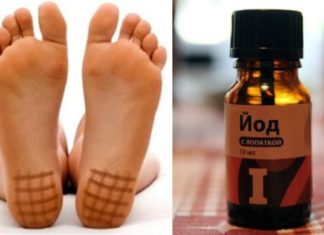 აი, როგორ და რატომ უნდა დაიხატოთ ქუსლებზე იოდის ბადე. მარტივი და ეფექტური სამკურნალო მეთოდი