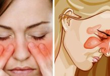 7 ხრიკი, როგორ მოვიცილოთ ჰაიმორიტი