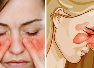 7 ხრიკი, როგორ მოვიცილოთ ჰაიმორიტი