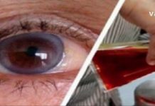 როგორ გავიუმჯობესოთ მხედველობა ოპერაციის გარეშე? ეს სახლის პირობებშიც შეგიძლიათ!