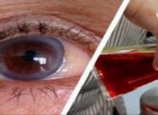 როგორ გავიუმჯობესოთ მხედველობა ოპერაციის გარეშე? ეს სახლის პირობებშიც შეგიძლიათ!