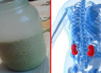 როგორ გამოვდევნოთ თირკმელებიდან კენჭები 15 დღეში? ეს საოცარი რეცეპტი დაგეხმარებათ ამაში!