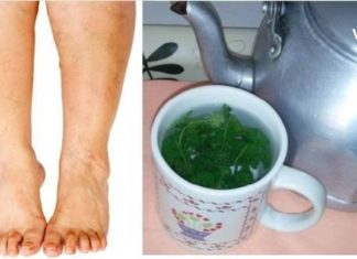 თუ ფეხების შეშუპება გაწუხებთ, მაშინ ეს რეცეპტი თქვენთვის ხსნა იქნება!