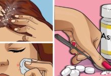 ასპირინის გამოყენების 9 გასაოცარი მეთოდი, რომელიც უნდა იცოდეთ!