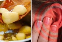 მოირჩინეთ ყურის ინფექცია 24 საათში-ყველაზე ეფექტური ბუნებრივი საშუალებები!