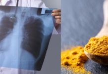 გაიწმინდეთ ფილტვები და მთლიანი ორგანიზმი ამ ნაყენის დახმარებით.