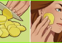 5 სუპერეფექტური მეთოდი ფერიმჭამელებისა და პიგმენტური ლაქებისგან გასათავისუფლებლად