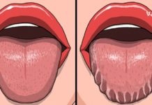 როცა თქვენი ენა ასე გამოიყურება, გაიგეთ რაზე მიგანიშნებთ