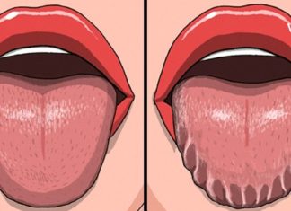 როცა თქვენი ენა ასე გამოიყურება, გაიგეთ რაზე მიგანიშნებთ