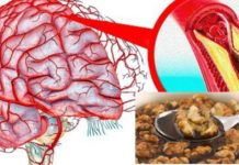 უნიკალური მეთოდი, რომელიც თავის ტვინის სისხლძარღვებს წმენდს. ეფექტური რეცეპტია