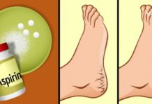 რით ვუშველოთ დამსკდარ ქუსლებს? ხერხი, რომლის შედეგს რამდენიმე წუთში ნახავთ