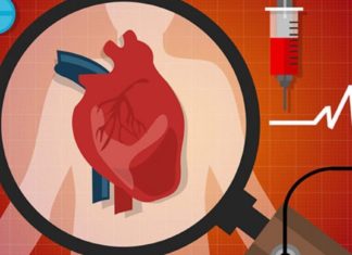 ის, რაც გულთან დაკავშირებულ პრობლემებზე მიგანიშნებთ. საჭირო ინფორმაციაა