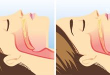 ეს 3 პროდუქტი ხვრინვის პრობლემას სამუდამოდ დაგავიწყებთ! ამიერიდან მშვიდად დაიძინებთ