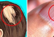 ვიტამინების ნაკლებობის სიმპტომები: რას უნდა მიაქციოთ ყურადღება? სასარგებლო ინფორმაციაა