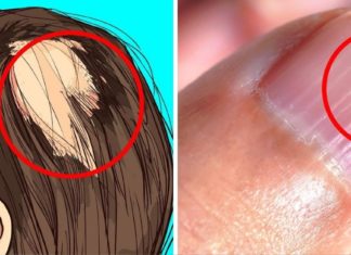 ვიტამინების ნაკლებობის სიმპტომები: რას უნდა მიაქციოთ ყურადღება? სასარგებლო ინფორმაციაა