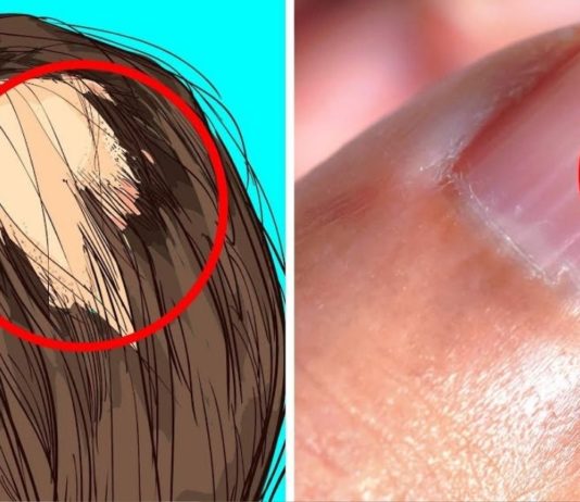 ვიტამინების ნაკლებობის სიმპტომები: რას უნდა მიაქციოთ ყურადღება? სასარგებლო ინფორმაციაა