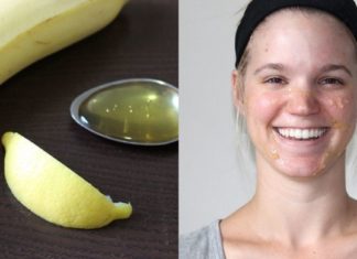 10 ყველაზე ბიუჯეტური ნიღაბი სახის კანისთვის, რომლებსაც სახლში მარტივად მოამზადებთ