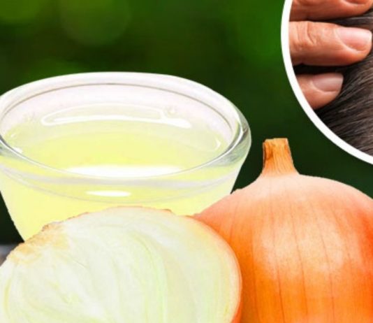 ამ ნატურალური რეცეპტის გამოყენებით თმა ორჯერ უფრო სწრაფად გაგეზრდებათ