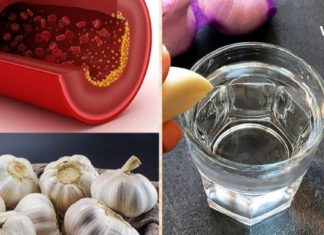 სასწაულმოქმედი რეცეპტი ათეროსკლეროზის, გულსისხლძარღვთა სისტემის დაავადებების წინააღდმეგ! მის მოსამზადებლად მხოლოდ ნიორი და წყალი დაგჭირდებათ .