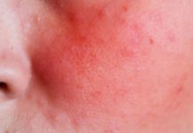 8 სიმპტომი, რომელთა იგნორირება არ შეიძლება. ის, რაც ყველასთვის საყურადღებოა