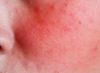 8 სიმპტომი, რომელთა იგნორირება არ შეიძლება. ის, რაც ყველასთვის საყურადღებოა