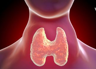 ფარისებრ ჯირკვალში კვანძები გაგიჩნდათ? ჩვენ მათი მკურნალობის ნატურალურ გზებს გთავაზობთ