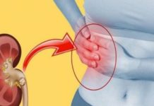 როგორ გავათავისუფლოთ თირკმელები კენჭებისგან? ყველაზე ეფექტური და სასარგებლო სიროფი