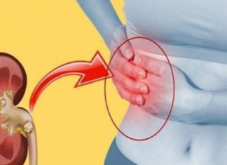 როგორ გავათავისუფლოთ თირკმელები კენჭებისგან? ყველაზე ეფექტური და  სასარგებლო სიროფი