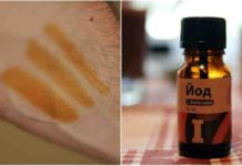 იცით რა მოხდება, თუ მაჯებზე იოდს წაისვამთ? ეს თქვენი ჯანმრთელობისთვის მნიშვნელოვანია!