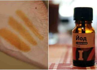 იცით რა მოხდება, თუ მაჯებზე იოდს წაისვამთ? ეს თქვენი ჯანმრთელობისთვის მნიშვნელოვანია!