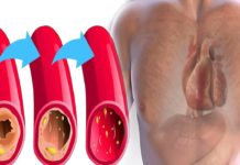 გაისუფთავეთ არტერიები მარტივად- სცადეთ საოცრად ეფექტური სასმელი