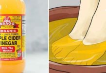 აი რა მოხდება, თუ ფეხებს ვაშლის ძმარში ჩაყოფთ. ასეთ შედეგს არ ველოდი!