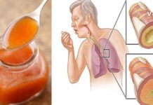 უძველესი ხალხური რეცეფტი, რომელიც წმენდს ფილტვებს და ხსნის ხველას