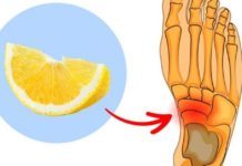 როგორ უნდა გამოვიყენოთ ლიმონის ქერქი ქუსლისა და სახსრების ტკივილის სამკურნალოდ? საინტერესო ინფორმაციაა